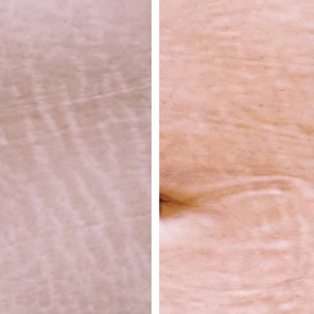 3 Sessions of ISR - Full Area at Flourish Skin Artistry in Redding, CA