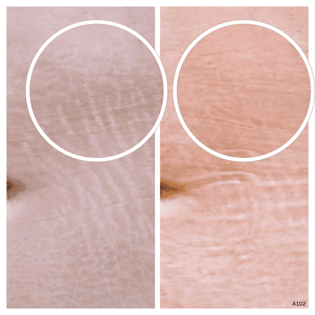 Three 4X4 sessions at Flourish Skin Artistry in Redding, CA